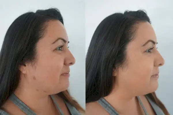 Dominique Lerma scab makeup tutorial