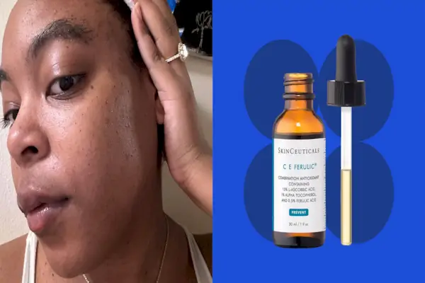 This Luxury Serum Cleared My Dark Spots In A Month