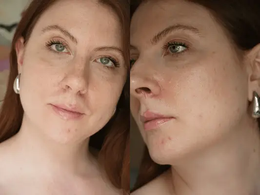 Before photos of Ashley Rebecca