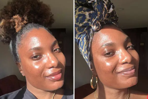 the ordinary alpha arbutin 2% + HA