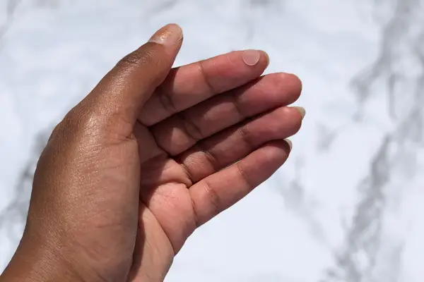 cosrx acne pimple master patch