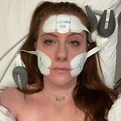 Woman trying Emface machine botox alternative