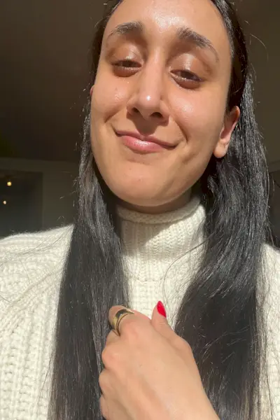 neha tandon før efter