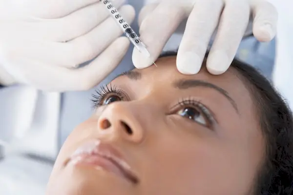 Botox treatment