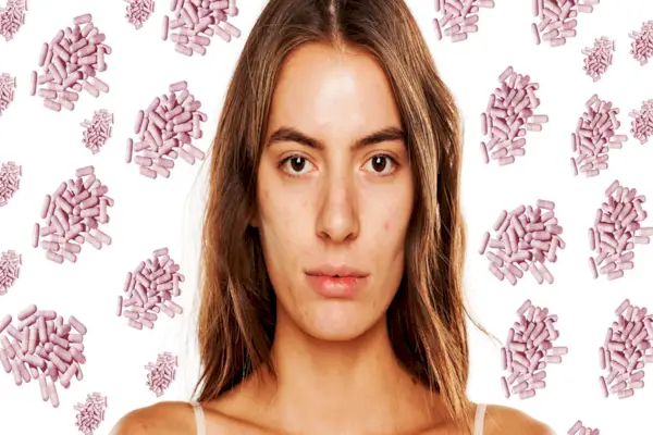 Face, Hair, Skin, Eyebrow, Cheek, Lip, Forehead, Nose, Chin, Beauty, 