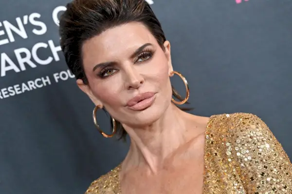 Olivia Culpo nastavila rekord v pověstech o plastické chirurgii – a sdílí, jaké kosmetické procedury provedla