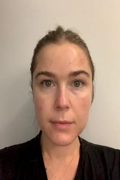 Cara, Ceja, Frente, Cabello, Barbilla, Mejilla, Cabeza, Nariz, Piel, Mandíbula,