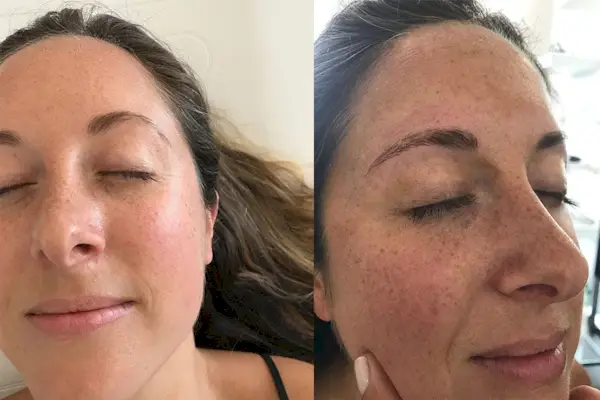 Kelli Accardio microblading before and after