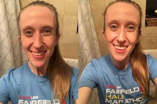 før og efter billeder af nicoletta richardson efter test af foliearkmaske