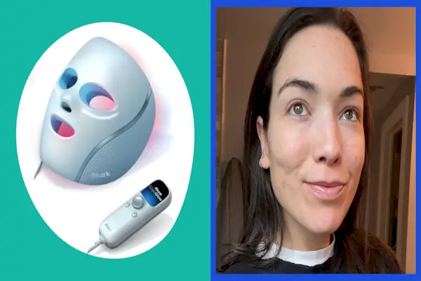 5 modi per sgonfiare velocemente il viso, secondo i dermatologi