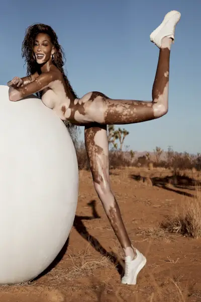 Winnie Harlow verwendete *dieses* Körperöl, um für ihr „Meltyourmakeup.com“-Cover-Shooting einen strahlenden Glanz zu erzielen