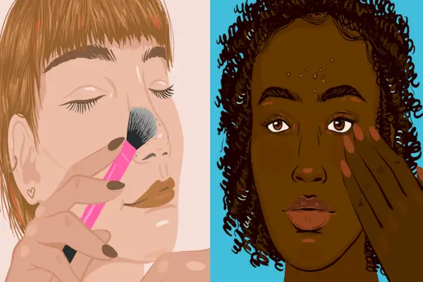 Was ist Pilzakne und wie wird sie behandelt, sagen Dermatologen?