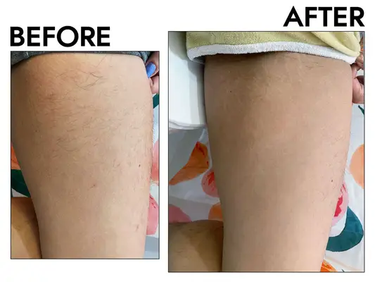A collage of at-home laser hair removal products we recommend on a beige background