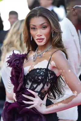 Winnie Harlow with blonde lowlights