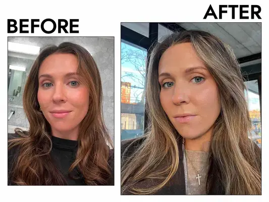 before and after of person using divi scalp serum