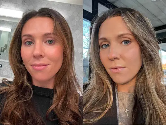 A person before and after using divi scalp serum