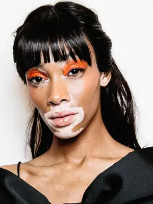 winnie harlow