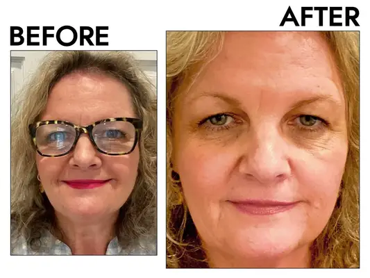 Close-up of a person with wavy blonde hair before and after using the L