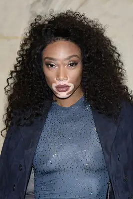 Winnie Harlow with curly hair 