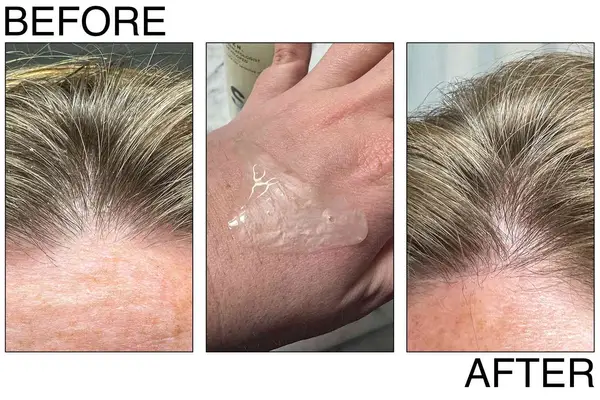 Klorane Soothing Shampoo with Peony