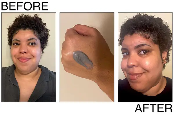 Dove DermaCare Scalp Anti Dandruff Shampoo