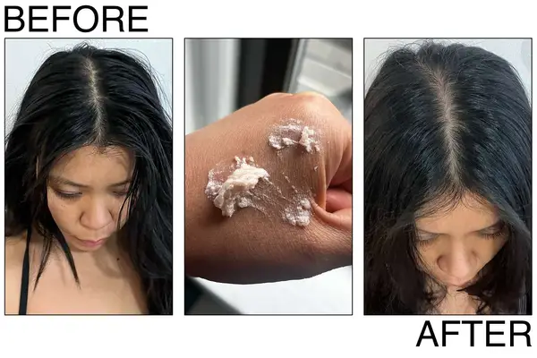 Briogeo Scalp Revival Micro-Exfoliating Shampoo and Cooling Hydration Scalp Mask