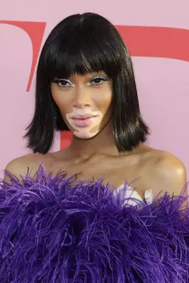 Winnie Harlow with 