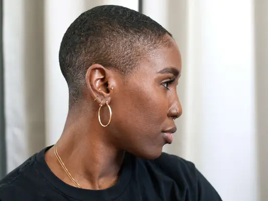 Wie man eingewachsene Haare auf Ihrer Kopfhaut beseitigt, so Dermatologen Angaben