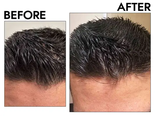 Virtue Labs Recovery Shampoo and Conditioner