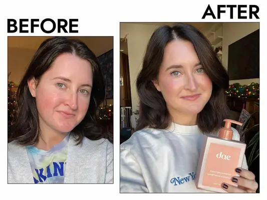 A before and after photo of a person using the Dae Shampoo