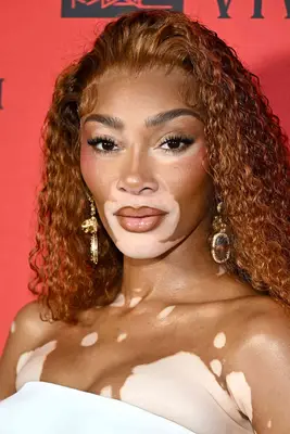 Winnie Harlow wearing cinnamon colored curly hair