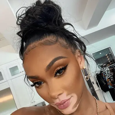 Lucy Boynton with blonde mid-length hair in milkmaid braid