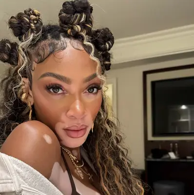 Winnie Harlow with Bantu knot buns and long curls 