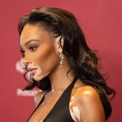Winnie Harlow posing from a side angle with hair styled in a no part curled style