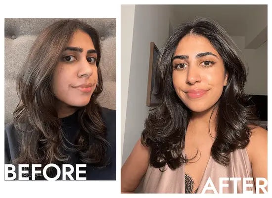 before and after photo of woman