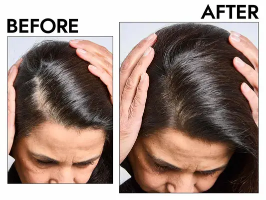 A before and after photo showing the effect of using dpHUE Color Touch-Up Spray