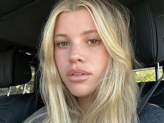 Sofia Richie wearing the Scandi hairline trend 