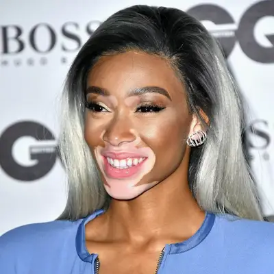 Winnie Harlow with a gray hairstyle