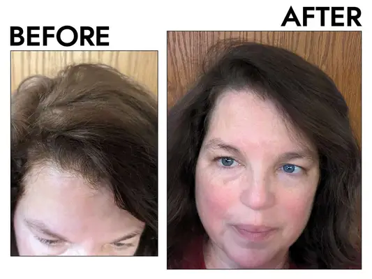 Act + Acre Plant Based Dry Shampoo