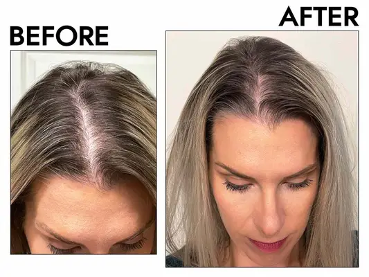 Briogeo Scalp Revival Charcoal + Biotin Dry Shampoo