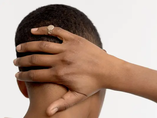 7 årsager til tør hovedbund, ifølge hudlæger