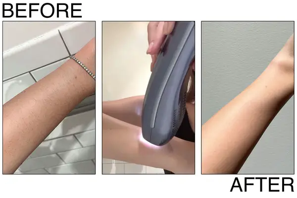 Braun Silk-Expert Pro 5