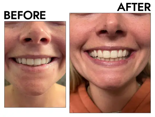 a tube of Sensodyne Pronamel Gentle Whitening Toothpaste on a bathroom counter