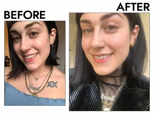 Photos of person’s face before and after using Crest 3D White Whitestrips with Light