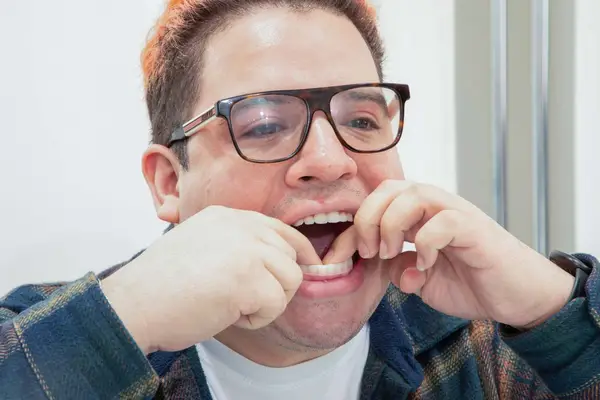 REMBRANDT Deeply White + Peroxide 1 Week Teeth Whitening Kit