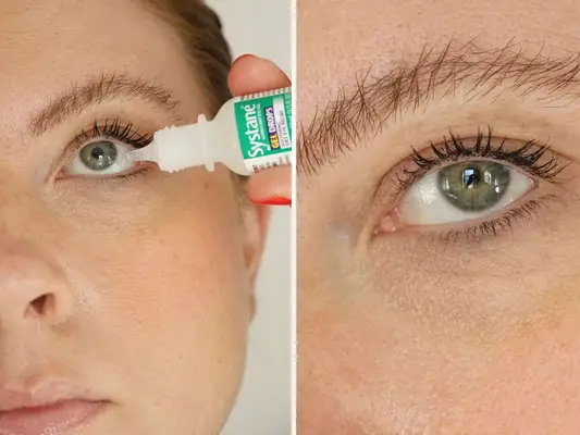 Las 12 mejores gotas para los ojos para ojos secos, picazón e irritados, según un ojo médico