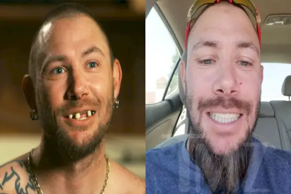 Król Tygrysów, nowe zęby Johna Finlaya