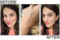 A person before and after using the L