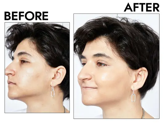Photos of person’s face before and after using It Cosmetics CC+ Cream Full Coverage Color Correcting Foundation with SPF 50+
