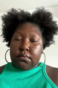 A person before applying L